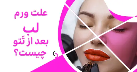 علت ورم لب، بعد از تتو چیست؟